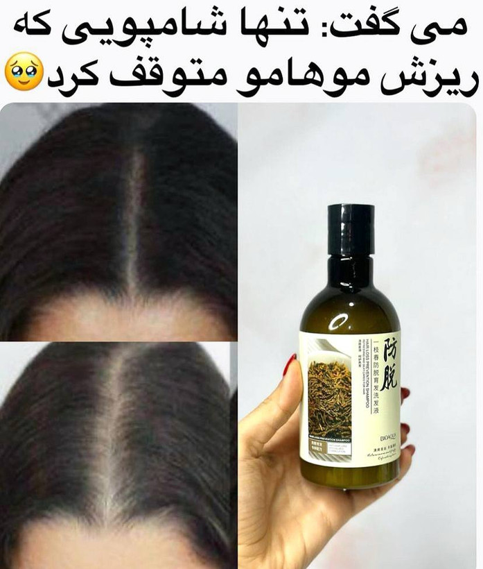 شامپو ضد ریزش مو رزماری اورجینال بیواکوآ حجم ۲۵۰میل شامپو تقویت کننده مو